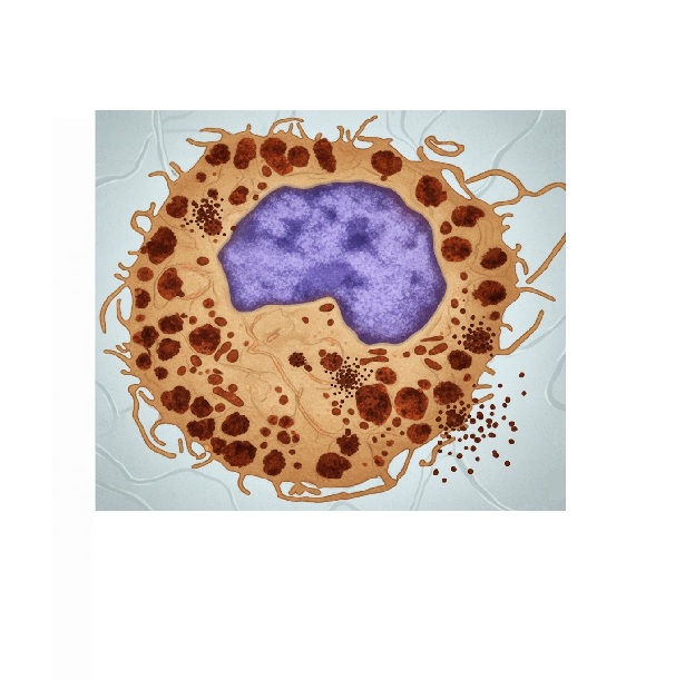 Mastzellaktivierungs-Syndrom – wenn die Mastzellen verrücktspielen